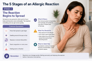 Illustration of early allergy symptoms such as itching, sneezing and watery eyes