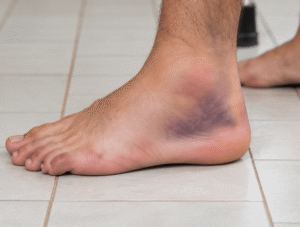 Clinician examining a patient's injured ankle to decide if emergency care is needed